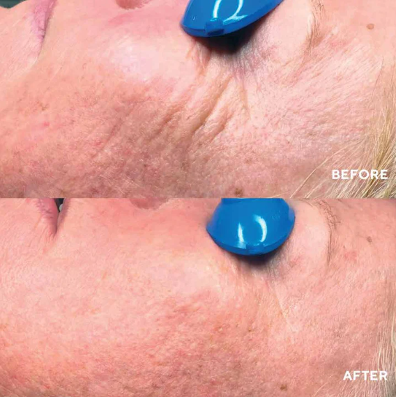 HydroPeptide Nimni Cream 15ml